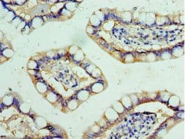 SHFM3 / FBXW4 Antibody (aa143-412)