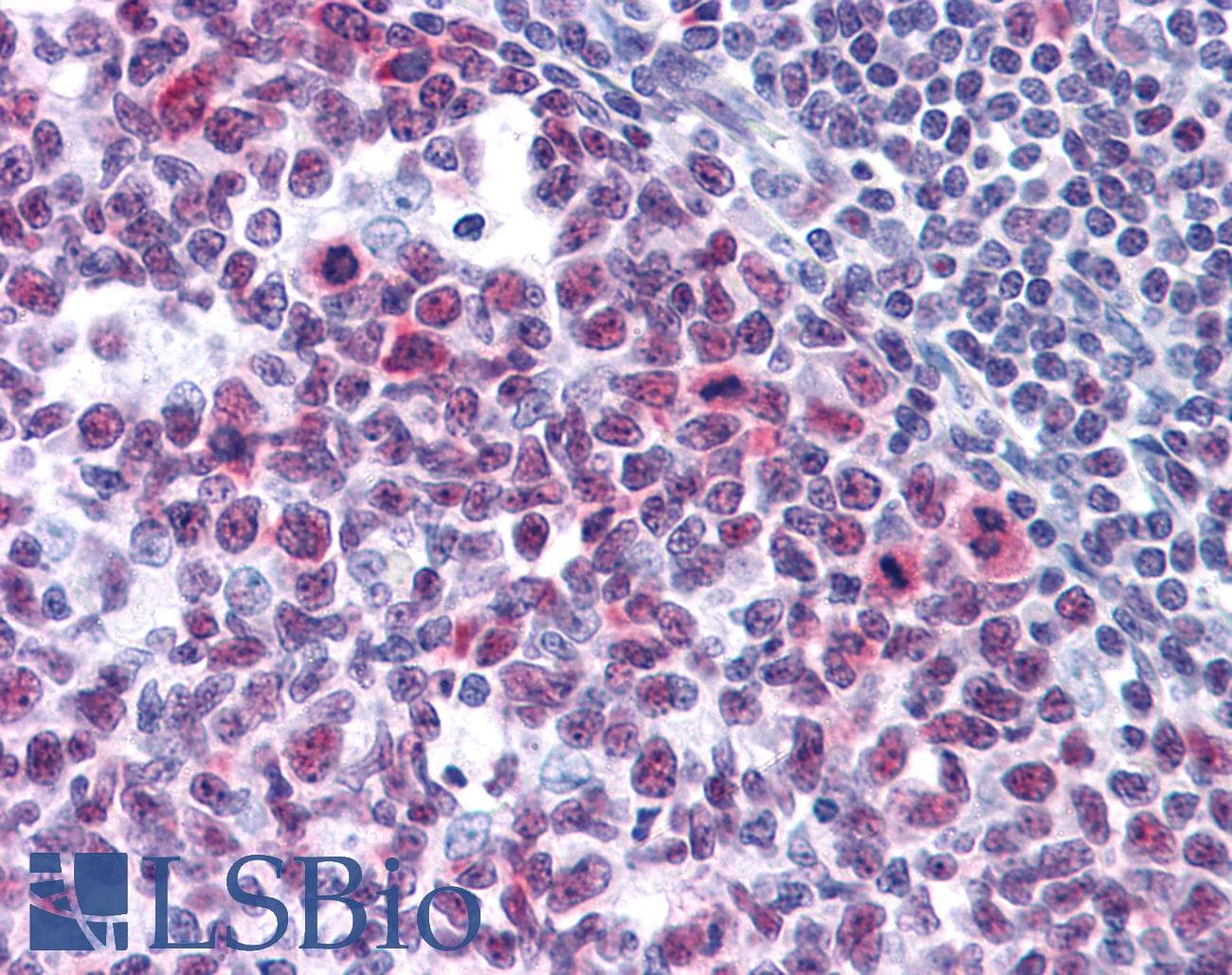 IHC-plus™ HMG1 / HMGB1 Antibody (clone 1D5)
