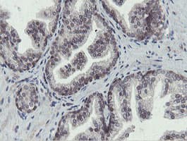 OTUB1 / OTU1 Antibody (clone OTI5B8)