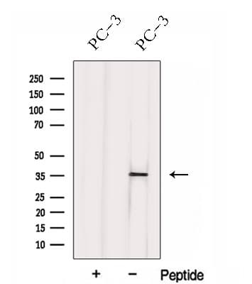 Polyclonal Rabbit anti-Human HNRNPH3 / hnRNP H3 Antibody (WB)