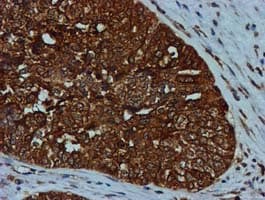 GATM / AGAT Antibody (clone OTI1E3, Carrier-free)
