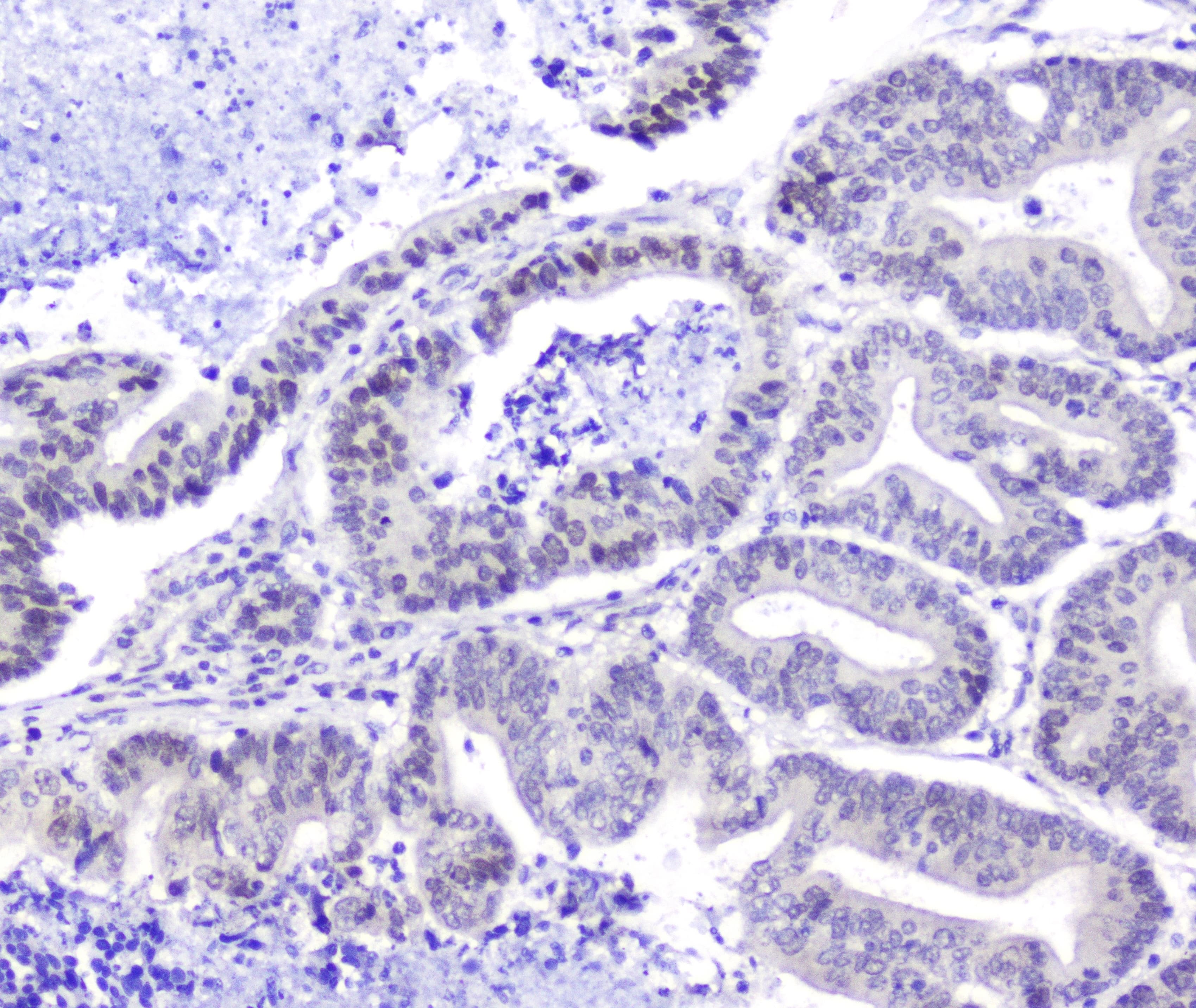 Polyclonal Rabbit anti-Human HSPH1 / HSP105 Antibody (IHC, WB)