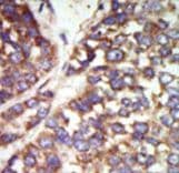 PAK2 Antibody (aa192-222)