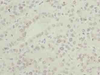 Polyclonal Rabbit anti-Human ASNSD1 Antibody (IHC)