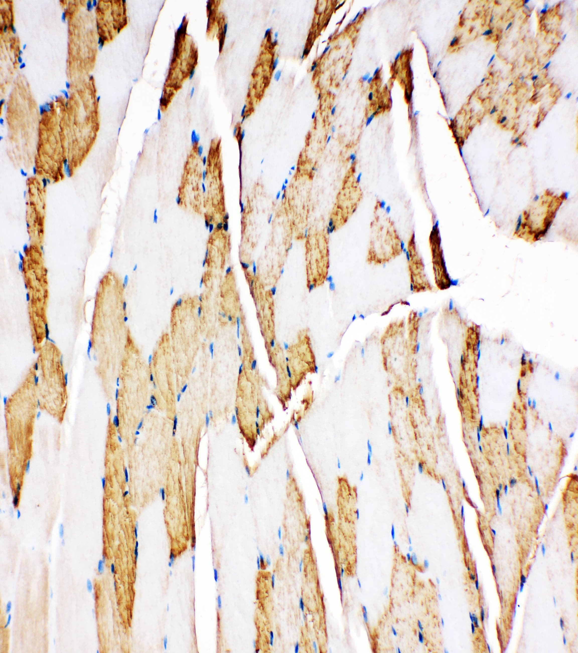 MB / Myoglobin Antibody (aa138-154)