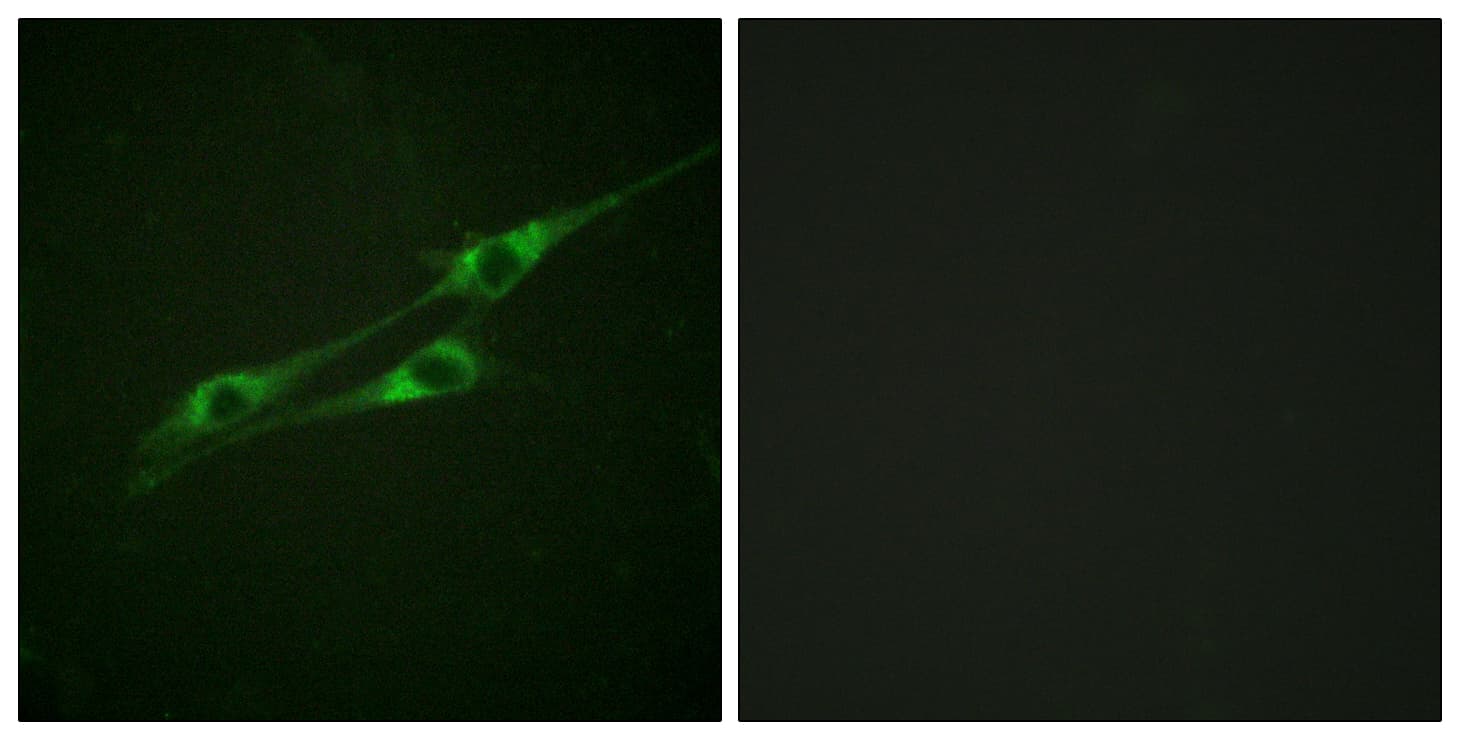 Polyclonal Rabbit anti-Human IL13RA1 / IL13R Alpha 1 Antibody (aa371-420, IHC, IF, WB)
