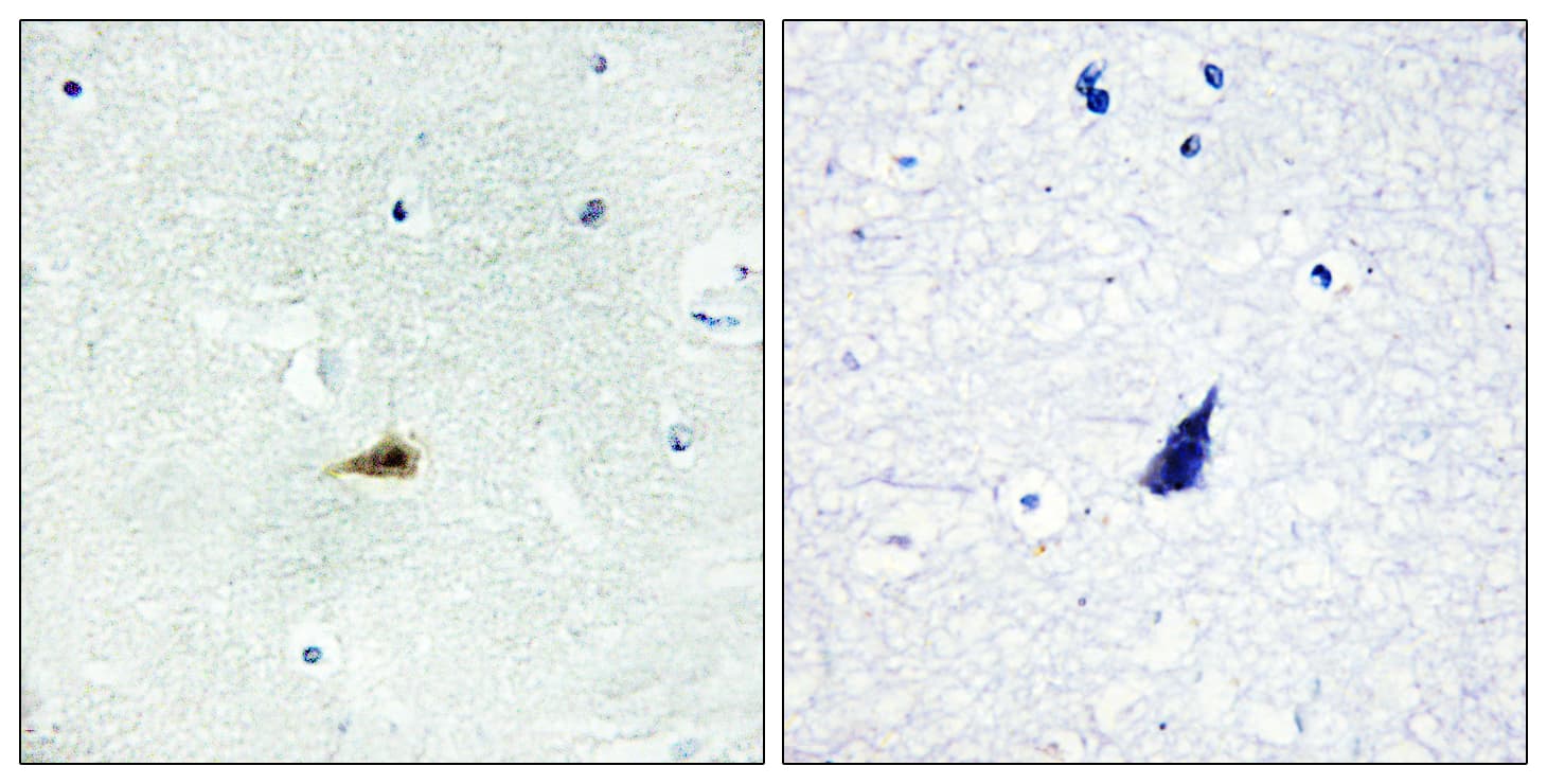 NCOR2 / SMRT Antibody (aa511-560)