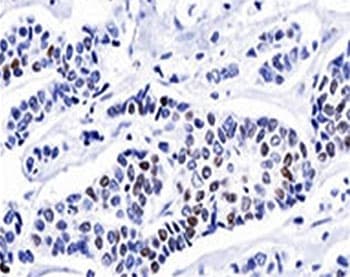 PR / Progesterone Receptor Antibody (clone PR501, Azide-free, BSA-free)