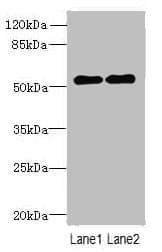 Polyclonal Rabbit anti-Human TRM6 / TRMT6 Antibody (IHC, WB)