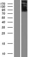 PROB1 Protein (Over-Expression Lysate Myc-DDK (Flag))
