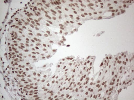 NR2C2 / TAK1 Antibody (aa1-241, clone OTI4B1)