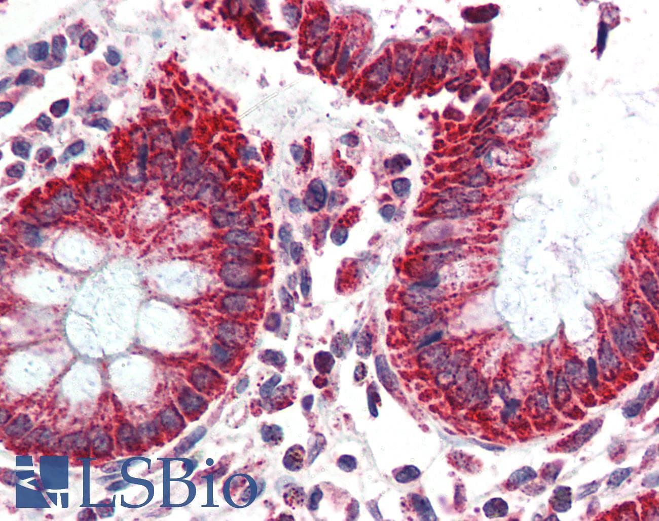 IHC-plus™ TSPO / PBR Antibody (aa156-169)