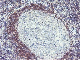 PLDN / Pallidin Antibody (clone OTI1H9)