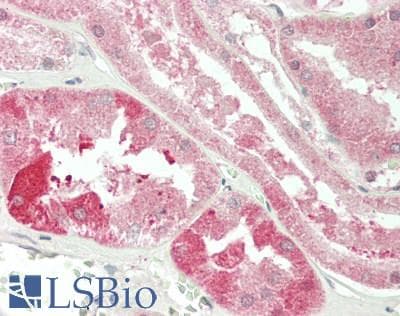 IHC-plus™ LYPLA2 Antibody