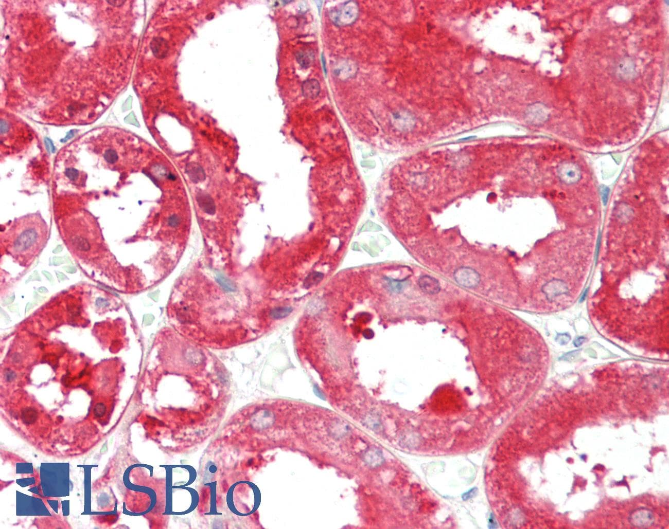 IHC-plus™ Monoclonal Mouse anti-Human ALDH1L1 Antibody (IHC, IF, WB)
