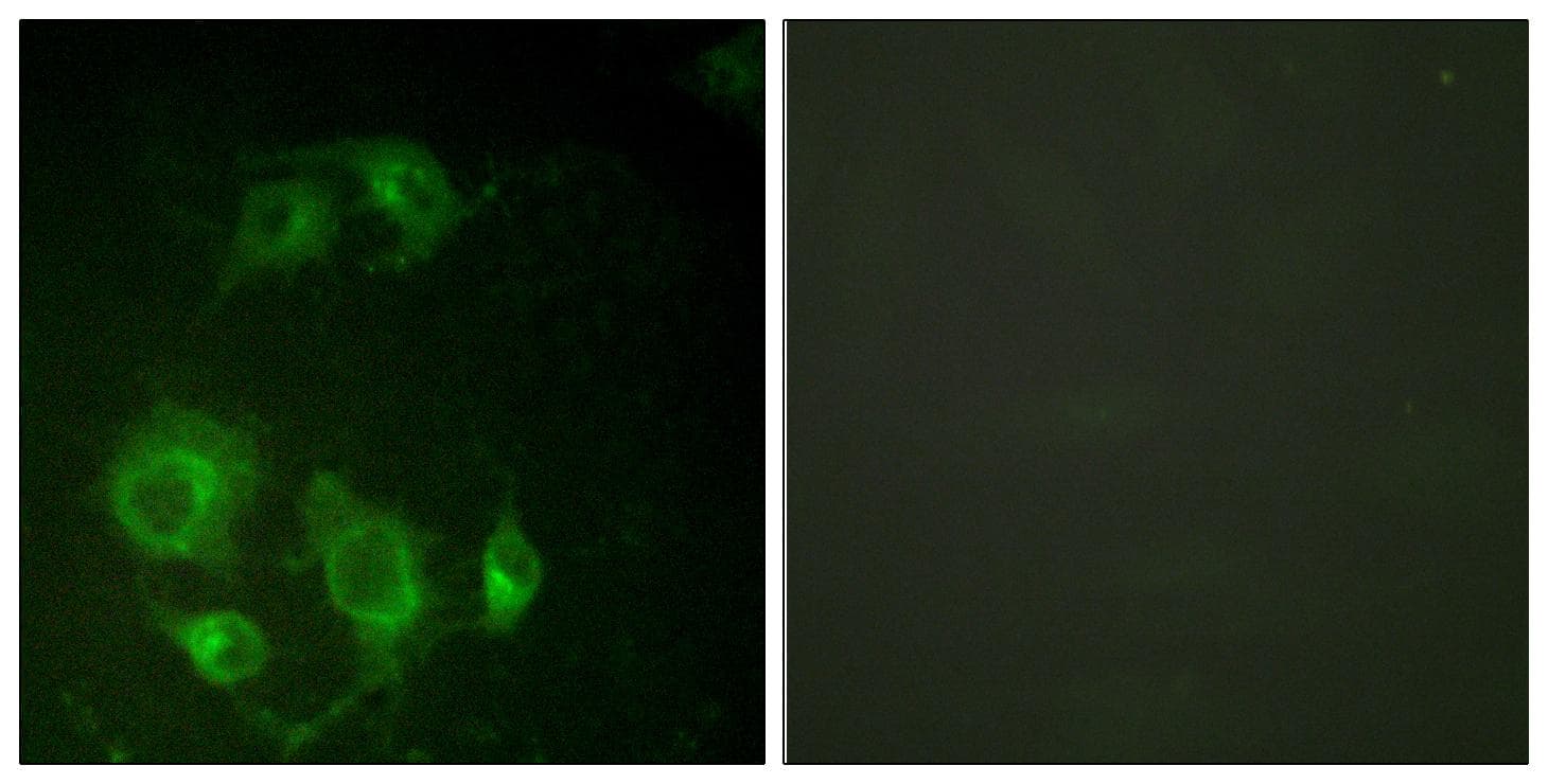 EGFR Antibody (p693)