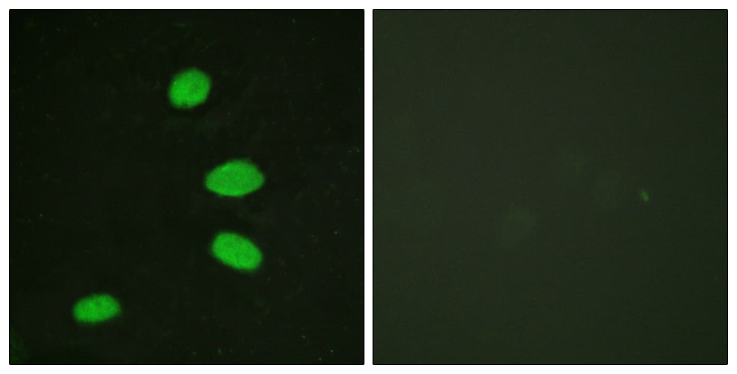 RBL2 / RB2 p130 Antibody (aa918-967)