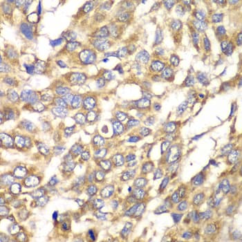 VTI1B Antibody