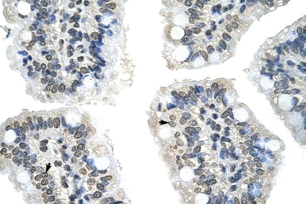 Polyclonal Rabbit anti-Human GIPC2 Antibody (N-Terminus, IHC, WB)