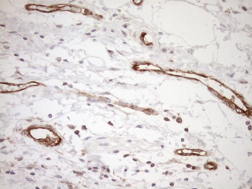 Monoclonal Mouse anti-Human ASPDH Antibody (clone OTI4G8, IHC)