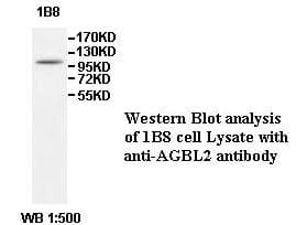 AGBL2 / CCP2 Antibody (aa63-281)