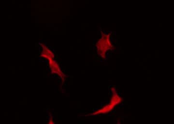 Polyclonal Rabbit anti-Human MAP2K3 / MEK3 / MKK3 Antibody (phospho-Ser189, IHC, IF, WB)