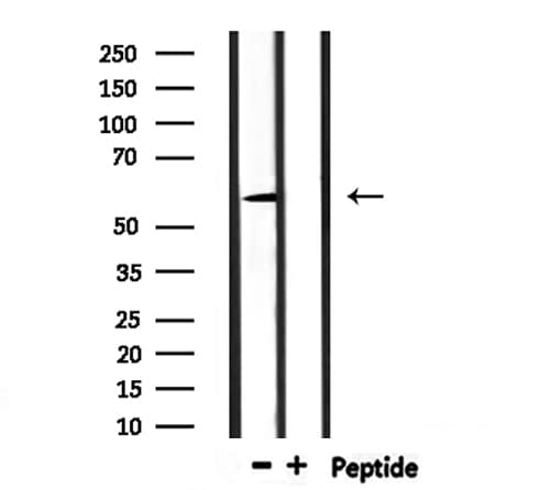 Polyclonal Rabbit anti-Human UGT1A9 Antibody (IHC, WB)