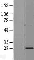 ETFBKMT Protein (Over-Expression Lysate Myc-DDK (Flag))