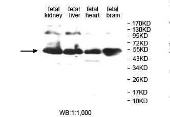 F9 / Factor IX Antibody (aa48-191)