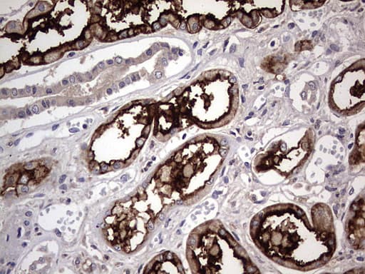 ACE2 / ACE-2 Antibody (aa18-237, clone OTI4C5)