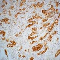 AMACR / P504S Antibody