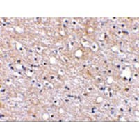 Polyclonal Rabbit anti-Human PLXDC2 Antibody (IHC, IF, WB)