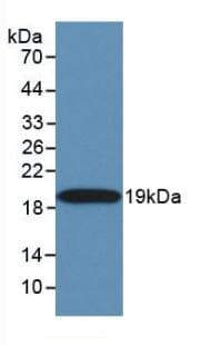 TNFSF10 / TRAIL Antibody (aa114-281, Cy3)