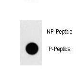 TAL1 Antibody (phospho-Thr90)