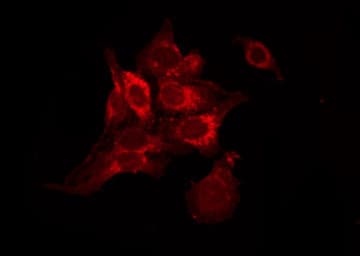 Polyclonal Rabbit anti-Human TACR2 / NK2R Antibody (IF, WB)