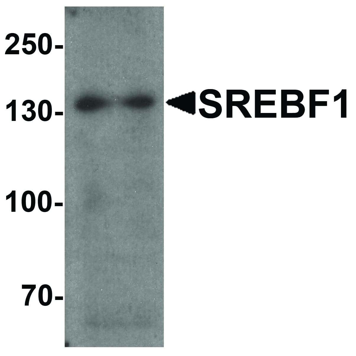 SREBF1 / SREBP-1 Antibody