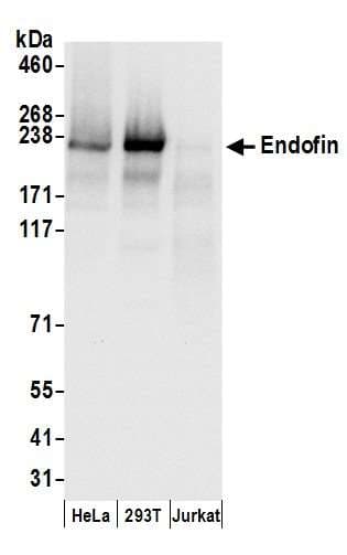 Polyclonal Rabbit anti-Human ZFYVE16 Antibody (aa450-500, WB)