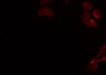 GALT4 / B3GALT4 Antibody