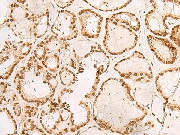 POM121 Antibody