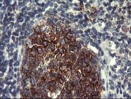 CD45 / LCA Antibody (clone OTI3B9)