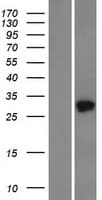 TMED5 Protein (Over-Expression Lysate Myc-DDK (Flag))