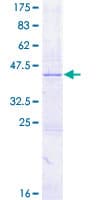 Human CYTL1 / C17 Protein (Recombinant GST)