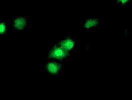 IHC-plus™ CDKN3 / KAP Antibody (clone 2E11)