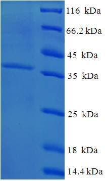 Human CSRP3 Protein (Recombinant His-SUMO)