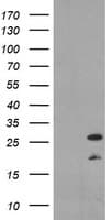 PYCARD / ASC / TMS1 Antibody (clone OTI1A2)