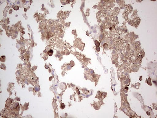 ROS1 / ROS Antibody (aa2126-2347, clone OTI1F3)