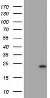 Monoclonal Mouse anti-Human UBE2E3 Antibody (clone OTI2B1, WB)