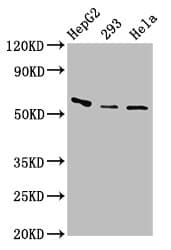 CFI / Complement Factor I Antibody