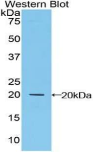 MFAP5 / MAGP2 Antibody (aa24-162)