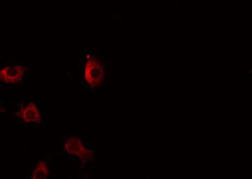 TNFSF12 / TWEAK Antibody